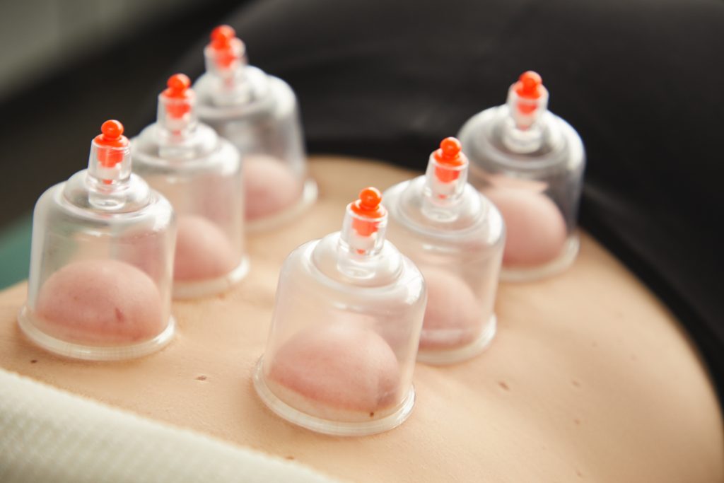 Cups for Cupping Therapy